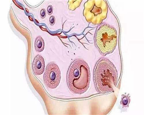 第三代试管婴儿价格大概是多少?费用可以报销吗