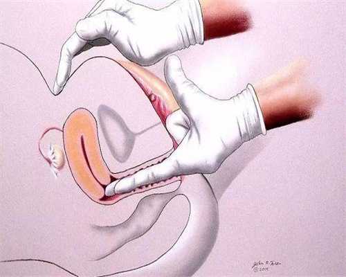 做找人做代生多少钱打降调针有什么用，对控制激素水平很有帮助