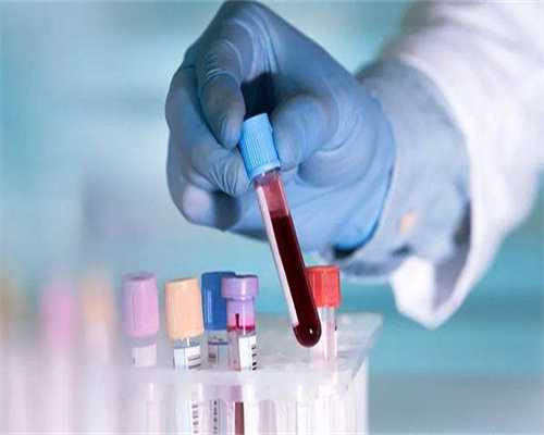 有梅毒可以做试管么吗男性-男人有梅毒可以做试管