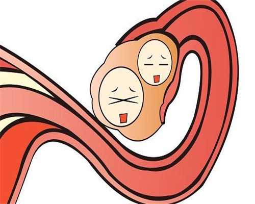 免疫性不孕能否做试管婴儿