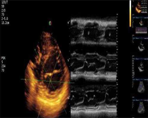 供卵三代包男孩_代怀包出生多少钱,
孕期吃了爱乐维还需要吃钙片吗