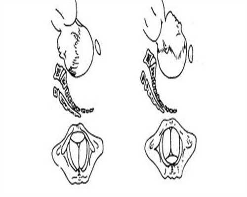 驻马店做试管大约多少钱一次 驻马店试管婴儿