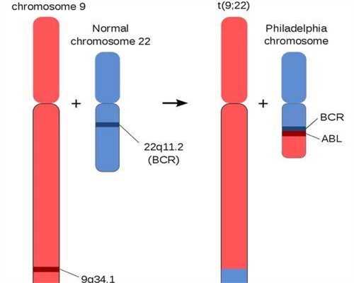 试管婴儿前宫腔检查什么 做试管婴儿前宫腔镜检查什么