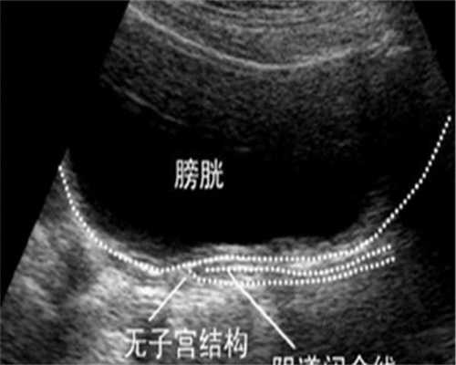 平顶山中医院做试管胚胎一次就着床成功的概率是多少?