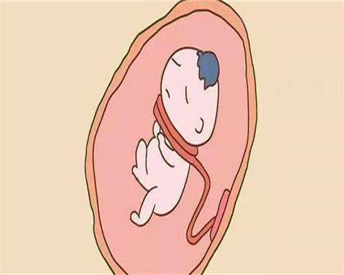 代生包生女孩吗_助孕包性别中心,孕期待产包最全清单一览!10万不一定够!