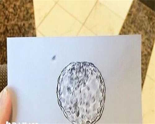 三代试管婴儿二次筛查费用