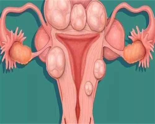 男方不孕不育可以做试管吗