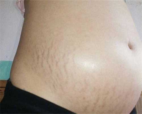 正规试管代怀：胎儿37周发育标准尺寸对照一览表，一眼看出胎儿发育是否正常