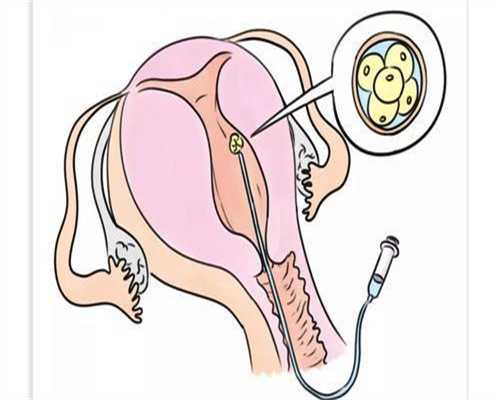 惜缘捐卵子公司+试管代孕权威医院是哪家,试管移植的胚胎质量不是**的能成功