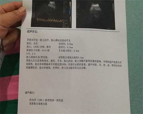 3bb囊胚质量是否可以供卵代生中心!经验分享!