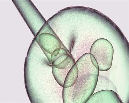 不明原因不孕做试管可以吗