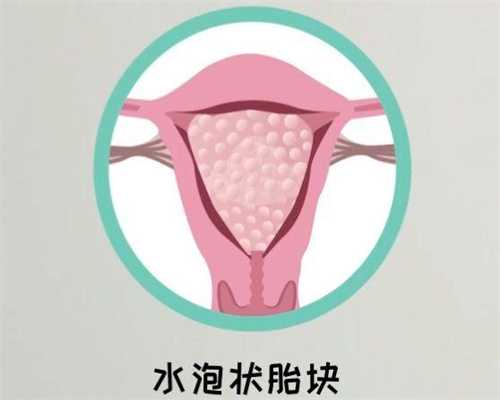 临沂山东包生代生流程费用是怎样的？能自己了解后再行动吗？